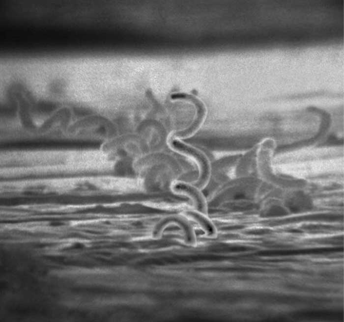 Syphilis under electron microscope