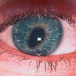 Pupils