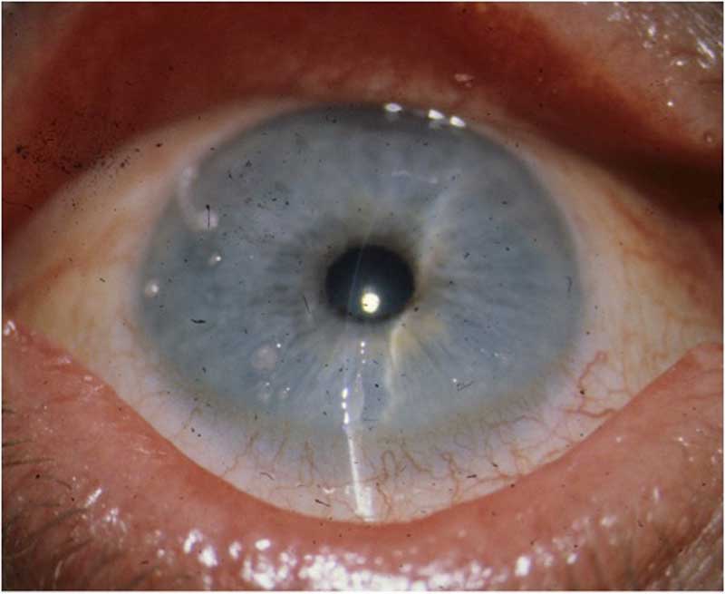 43-year-old male presents to your clinic...