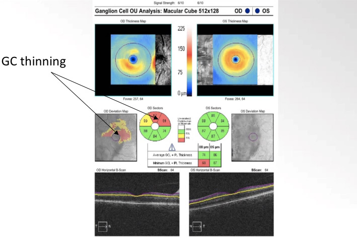 Neuro Coach #2 Analysis