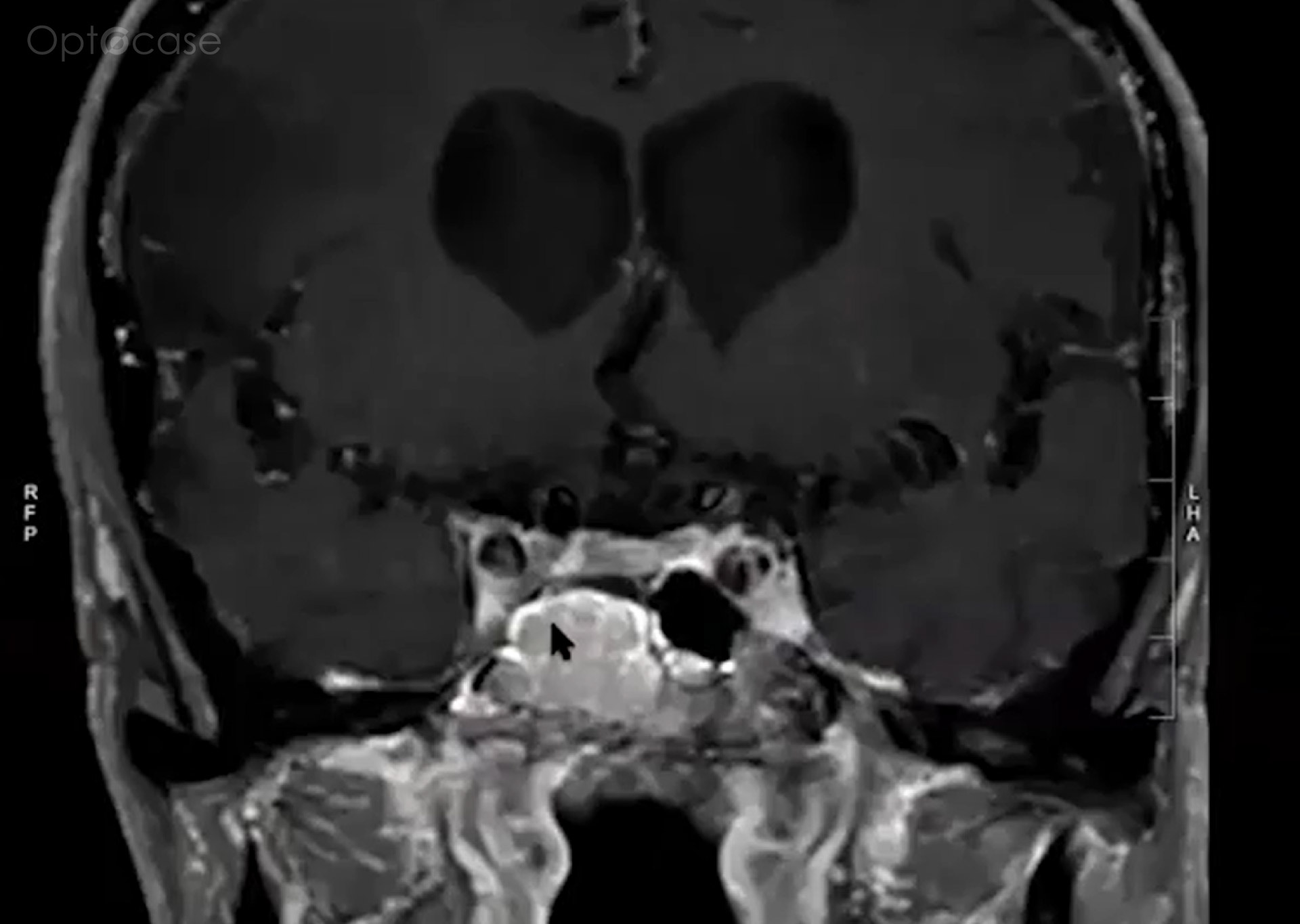 Neuro Coach #014 Analysis
