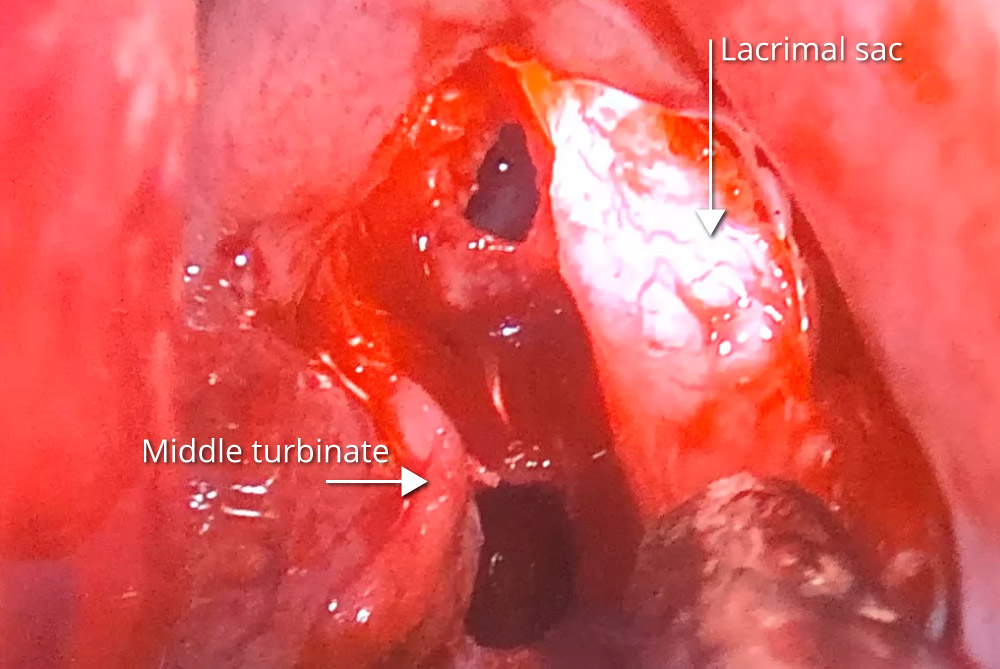 Plastics Coach #8 Analysis