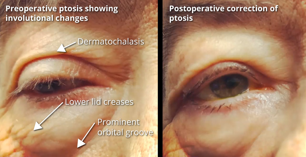 Plastics Coach #9 Analysis